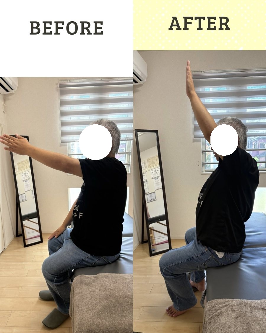 座って腕を上げる動きの施術前後の比較
